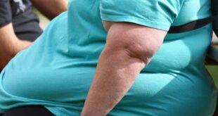 conséquences de l'obesite