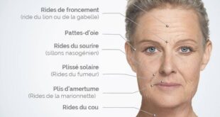 nom des rides du visage