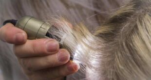 diagnostic perte de cheveux