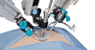 laparoscopie à port unique en chirurgie gynécologique