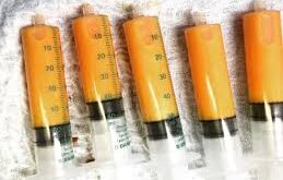 G comme Greffe de graisse : Principe, indications et bénéfices en chirurgie esthétique et reconstructrice